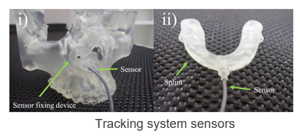 Navigation System for Orthognathic Surgery